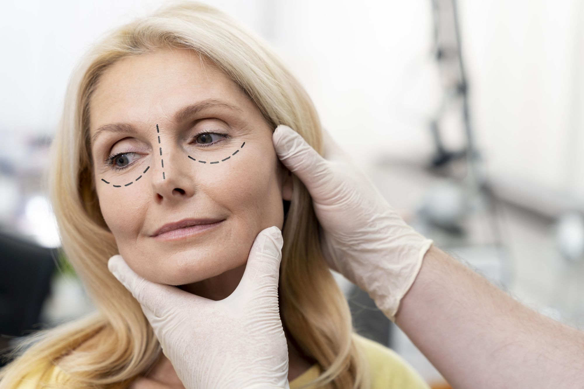 Blefaroplastia – tot ce trebuie sa stii despre operatia estetica de remodelare a pleoapelor
