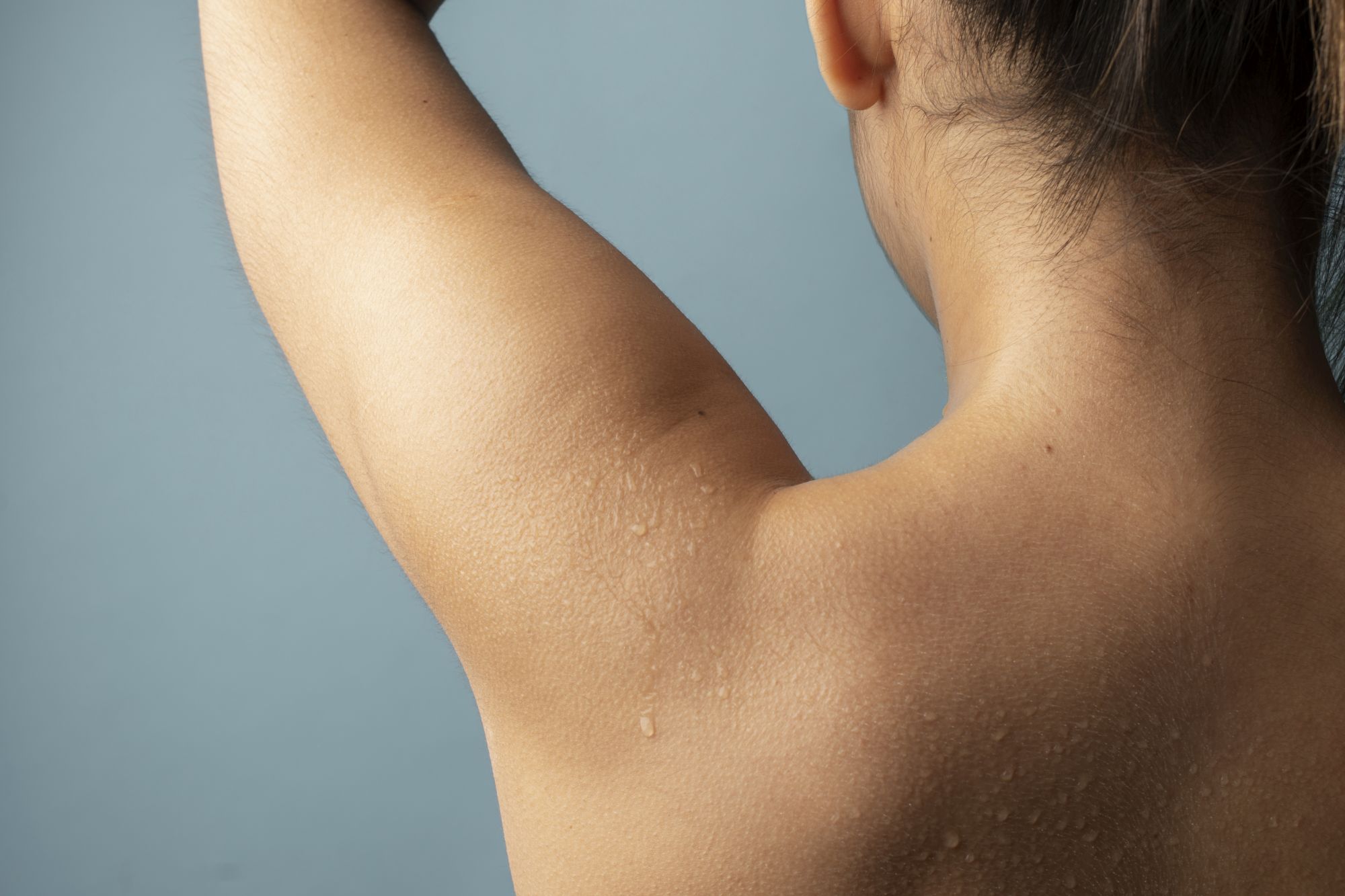 Injectii cu Botox pentru transpiratia excesiva – hiperhidroza